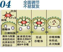 生殖感染:全面调节 不易复发